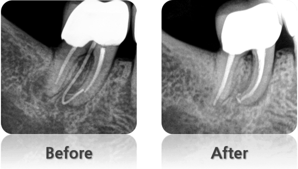 case6_1